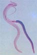 Schistosoma haematobium, gusano parasitario causante de la esquitomatosis